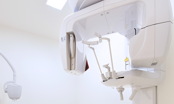 デジタルレントゲン