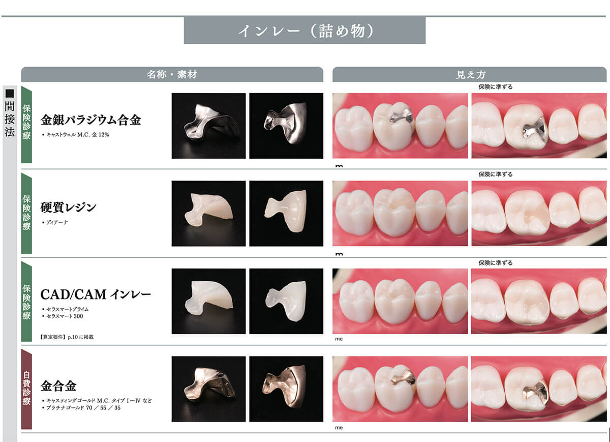 当院で取り扱う詰め物・被せ物の特徴02