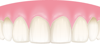 医療ホワイトニングのメカニズム03
