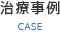 治療事例